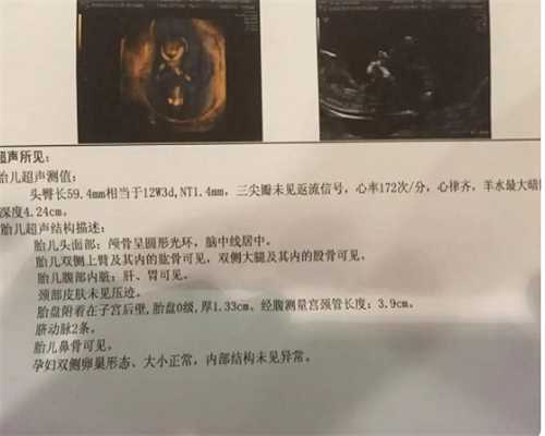天津代孕机构有被罚的吗,武汉试管婴儿第三代价格多少-上海供卵试管双胞胎