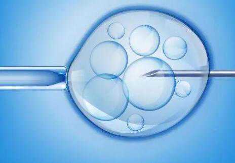 代怀双胞胎费用_借卵子代怀_荆州一医生殖中心做试管婴儿男性怎么取精子？